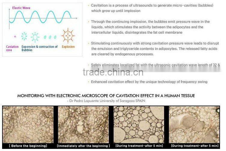 Slimming Equipemnt vacuum home use rf equipment (ostarbeauty )