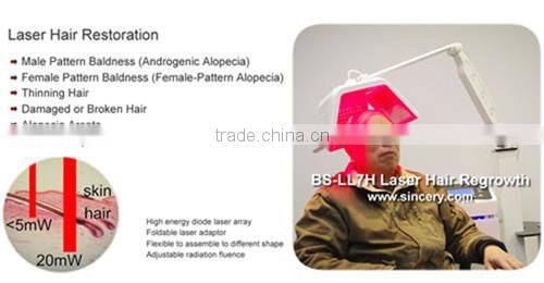 Beauty Salon Sequipment 650nm Laser Diode Machine Hair Regrowth Anti Hair Loss Treatment Equipment