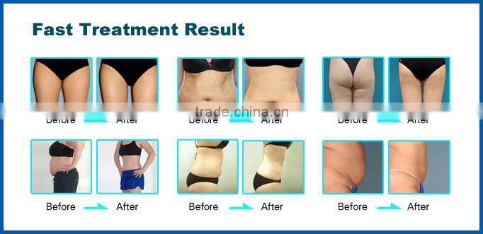 650nm Spa use 12 pads laser cavitation slimming machine with CE ISO13485