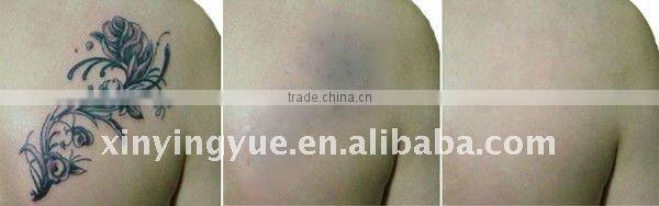 Mini table Yag laser tattoo removal equipment