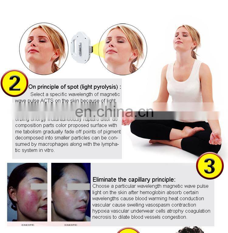 Factory Direct Sales IPL Laser Lair Removal Power Supply Photo Rejuvenation machine in Renlang Beauty Machine