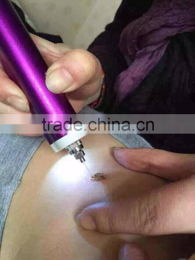 2015 New Wholesale Professional mini Tatoo Spot Mole Laser Remover freck spot removal laser pen
