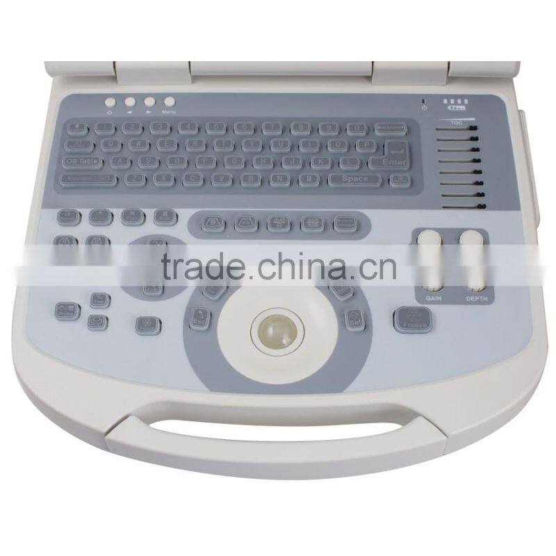 New hot selling portable ultrasound scanner / ultrasound machine suitable clinic community