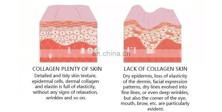 Mini RF Beauty Equipment That  repair skin/ regenerates Skin/ Anti-aging