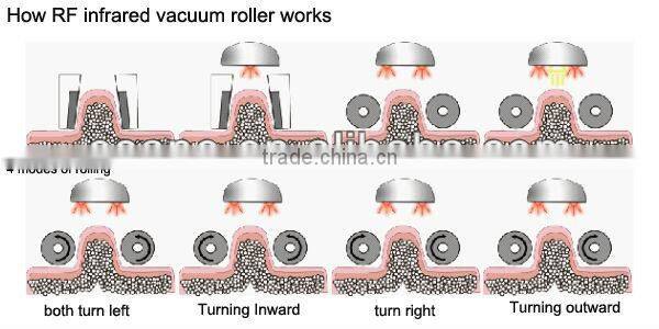 Cryo Machine+Vela Shape Slimming machine Cryotherapy machine RF equipment