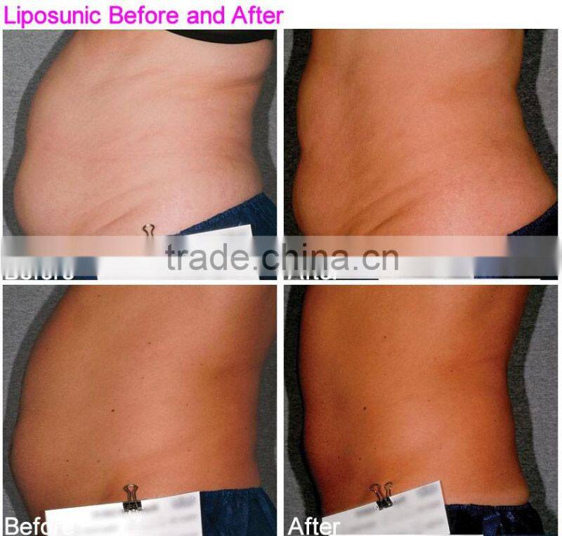 beauty salon use weight loss liposunic Slimming Machine