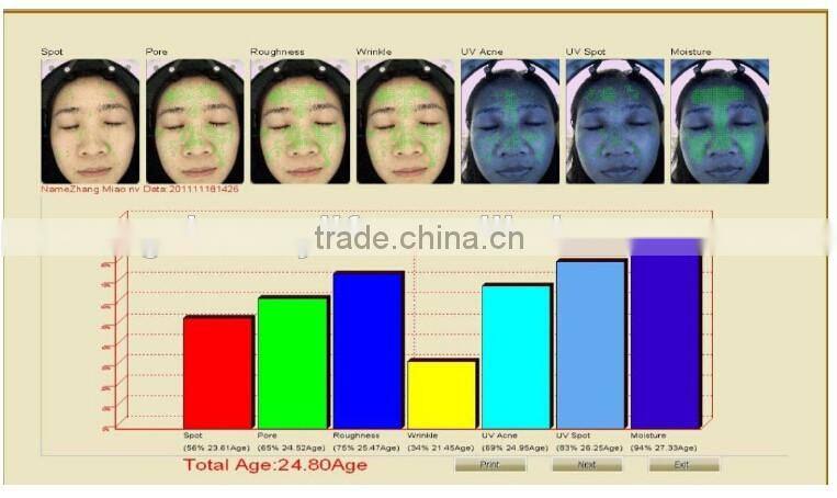 Skin Analyzer Type skin analyzer