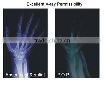 Quick Drying and Least Loss of Gypsum Powder Plaster Cast Bandage