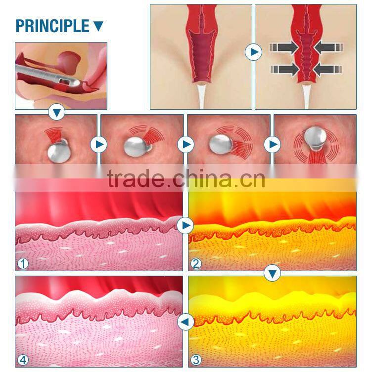 co2 fractional laser system for shrink vagina
