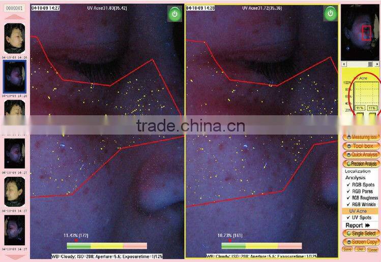 portable skin analyze machine/uv skin analyzer/skin analyzer