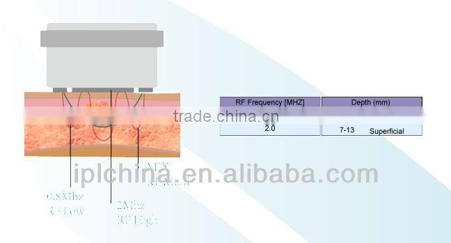 New Products 2014 Body Sculpting Beauty Salon Machine-PEMF Shape 2