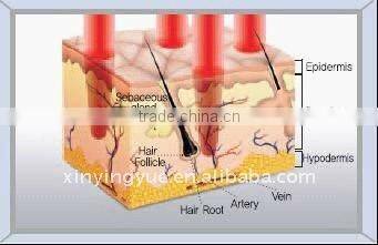 professional C02 laser