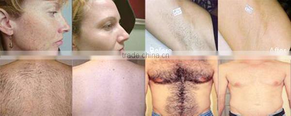 New shr ipl equipment for distributor Vertical IPL SHR&E-light hair removal equipment&machine