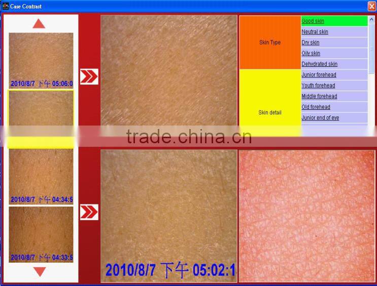 High precision digital skin moisture monitor UV skin analyzer with CE