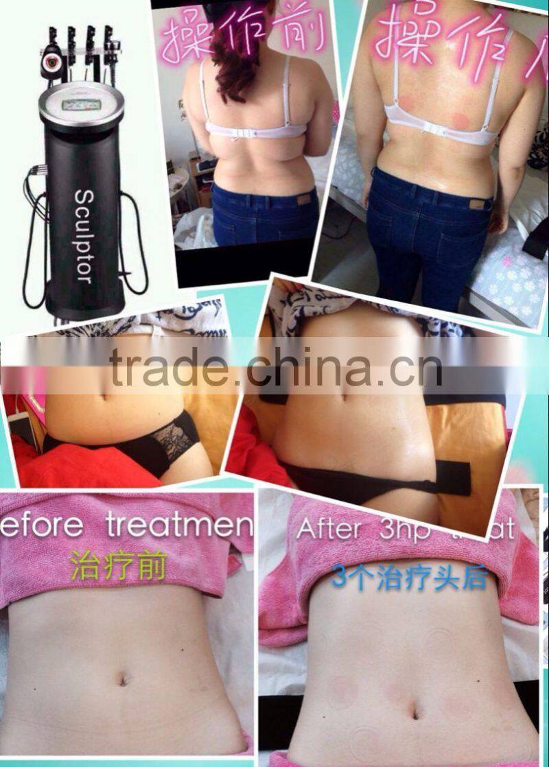 6 in 1 ultrasound + RF multifunctional cavitation weight lose machine