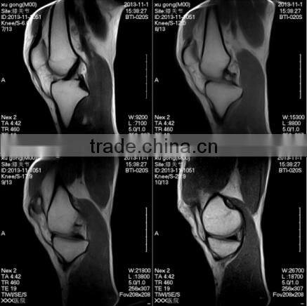 hospital MRI equipment MRI machine MRI scan for sale