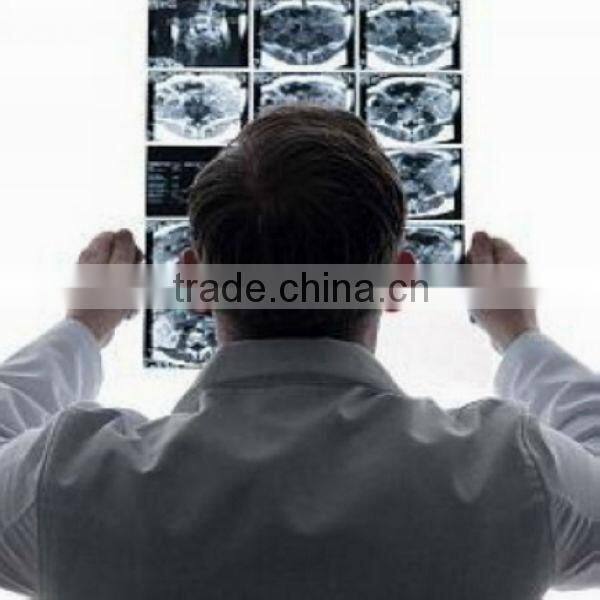 MEIQING x-ray film/hospital film/inkjet printing ultrasound film