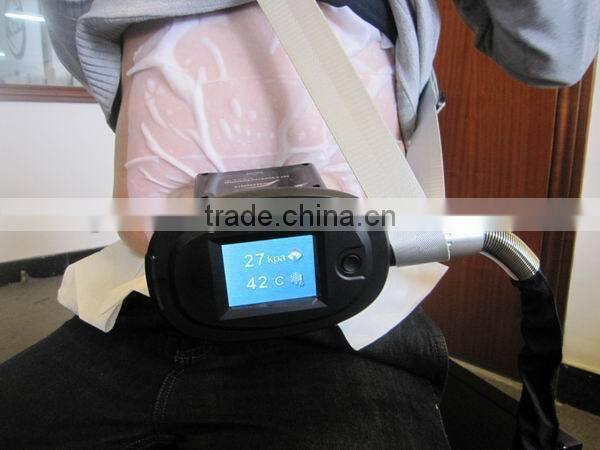 portable cryolipolysis equipment