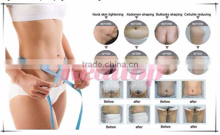 Manufacturer For Portable Skin Rejuvenation RF Body slimming machine cavitation