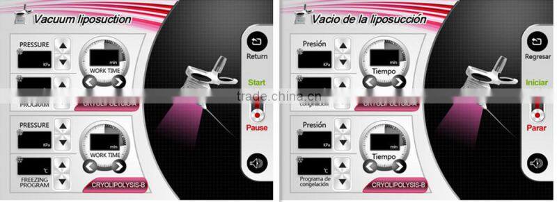 Promotion cryolipolyse machine vertical weight loss feature kryolipolyse