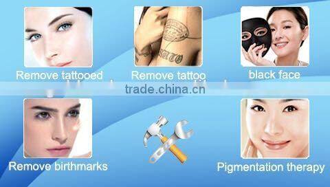 HOT!! professional laser tattoo removal machine
