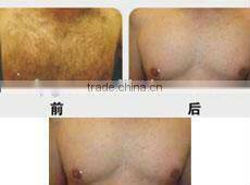 2013 new design E light beauty machine
