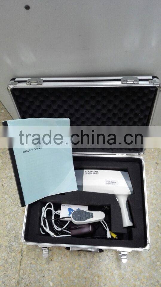 Digital Video Colposcope, Laptop Video Colposcope, Gynecology Video Colposcope