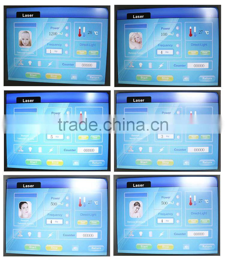 professional q-switch nd:yag laser removal tattoo machine for sale