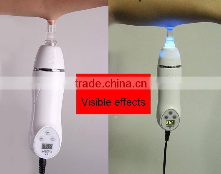 Hottest 6 Tip Facial Care Beauty Device scar removal machine black head remover machine with FDA