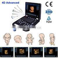 Coupon available! Ipad ultrasound scanner, touch screen scanner 3D color doppler MSLCU22-N