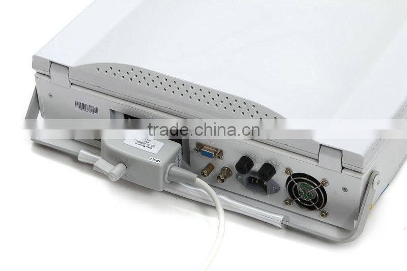 15-inch Laptop Ultrasound Scanner with Multi-frequency probes