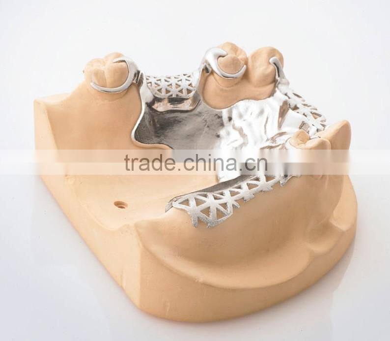 Mini 100w laser welding machine for Dental industry with internal water cooling system welding machine for metal