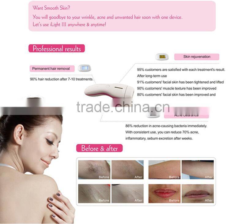Newest household IPL hair removal equipment with lamp replaceable