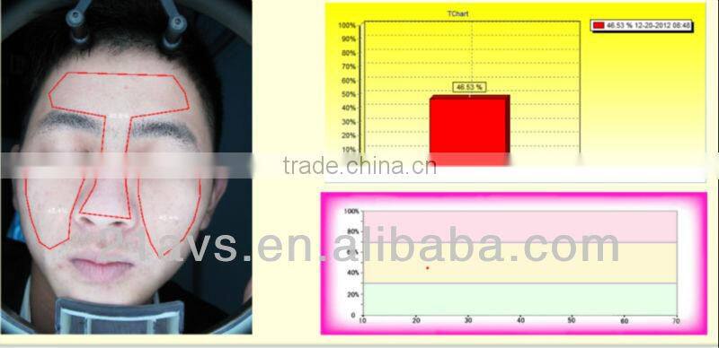Professional Facial Skin Analyzer Magic Mirror with software system for beauty salon