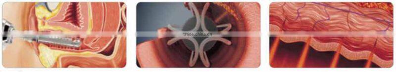 2016 best-selling fractional laser co2 skin resurfacing / scar removal treatment high power co2 laser cutting machine