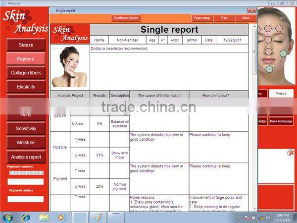 New Product Portable Facial Skin Analyzer Beauty Equipment