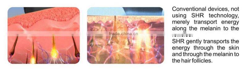 china suppliers ipl handpiece ipl shr laser