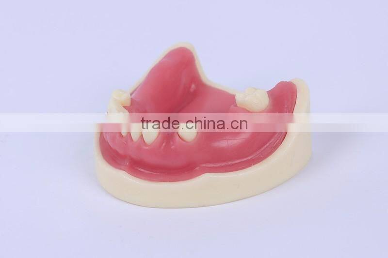 New Type Good Quality Dental Implant Model with teeth