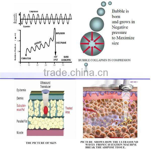 New Innovative 4 in 1 Beauty Machine