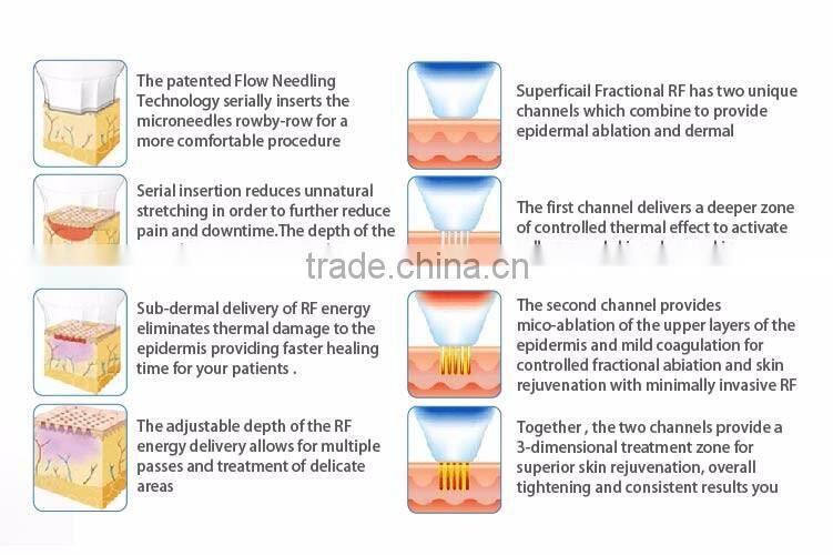 Easy to delegates ergonomically stretch mark radiofrequency machine for skin tightening