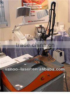 CO2 fractional laser (15W) for scar removal