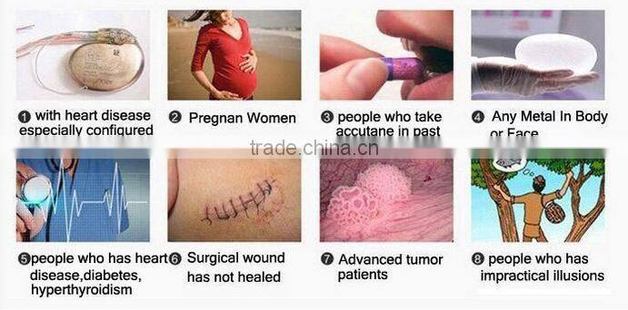 Merry christmas present !portable hifu rf wrinkle removal skin tightening machine for home use