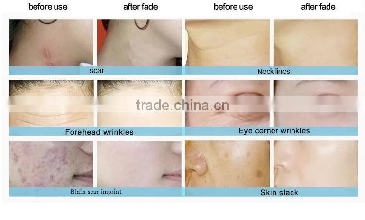 best supplier china special material silicone skin cleansing brush