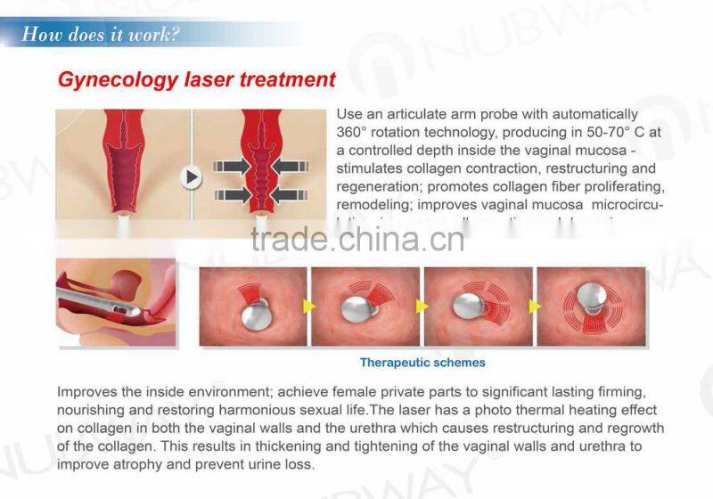 fractional laser co2
