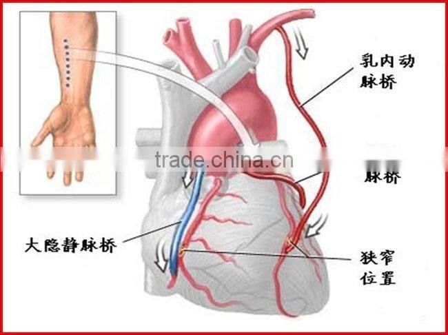 Semiconductor laser treatment instruemnt