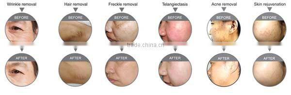 Investor Looking For Invest Ipl Salon Equipment