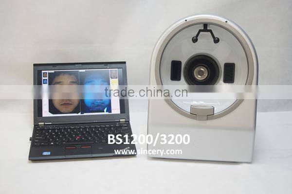 2014 Newest computer skin analyzer Suitable For Windows 8 and windows 8.1