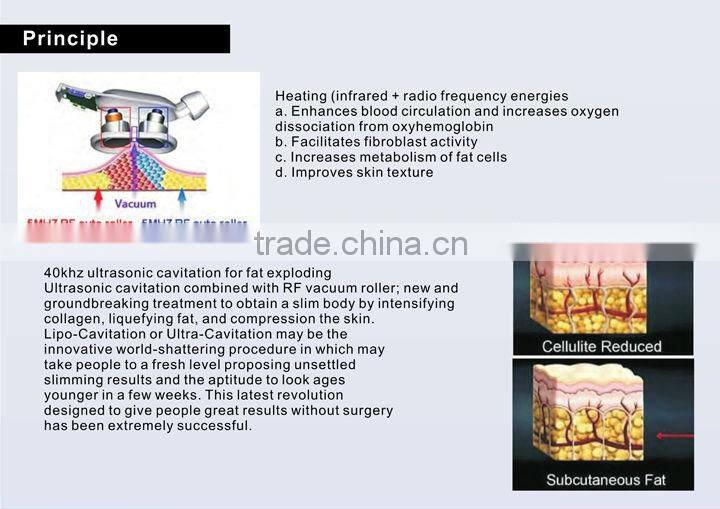 Vacuum Roller Slimming Machine--VelashapeIII