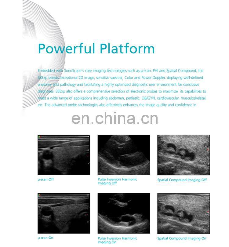 Professional 4D Color Doppler Sonoscape ultrasound scanner/Portable Sonoscape S8 EXP/Sonoscape ultrasound