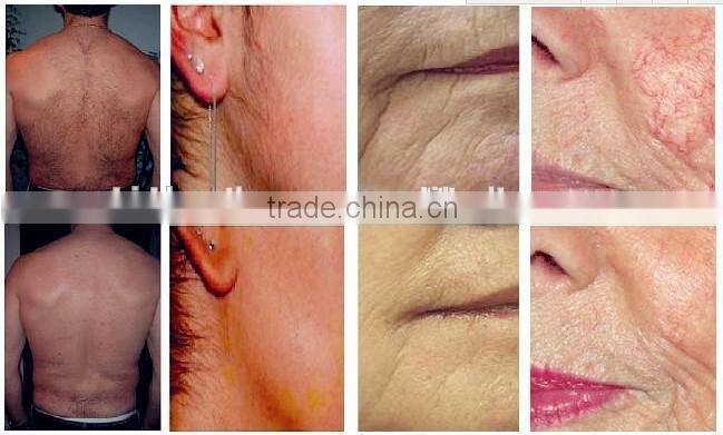 2014 beauty salon equipment Angel portable ipl hair removal system